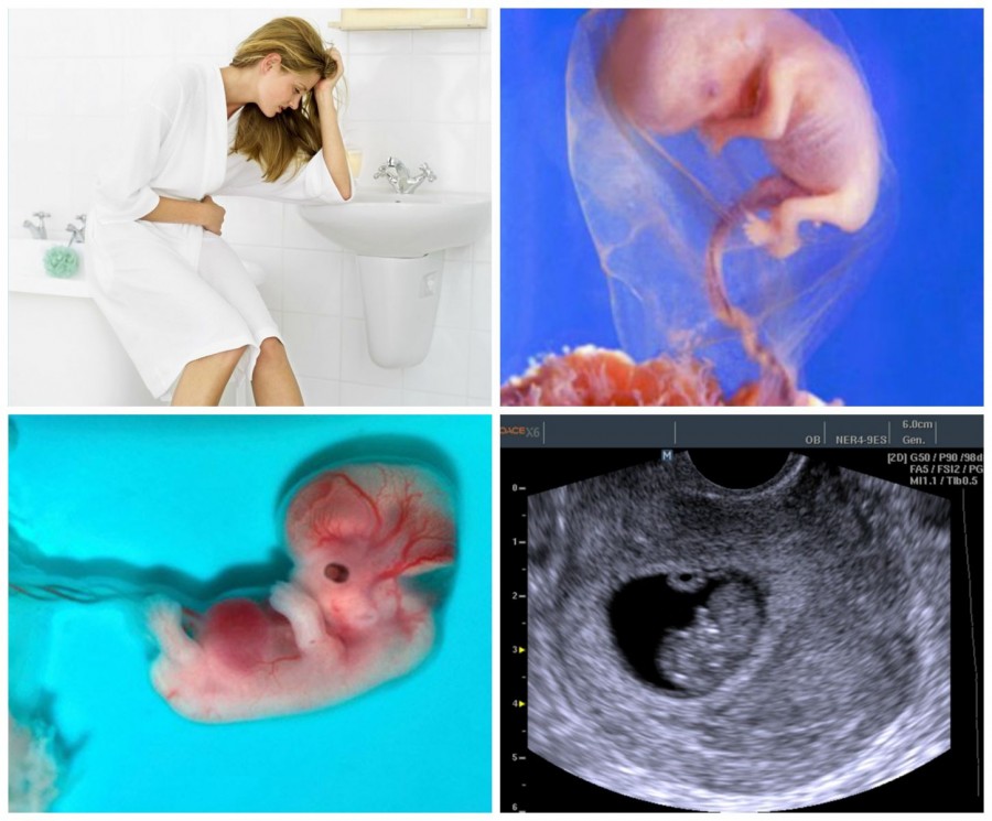14 неделя беременности - размер и вес плода, фото и УЗИ ребенка, нежелательные признаки и симптомы