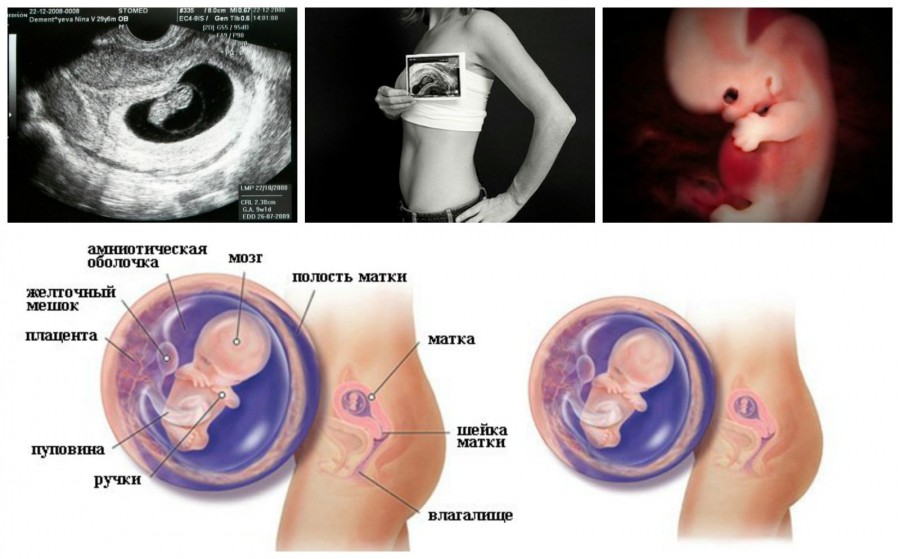 14 неделя беременности - размер и вес плода, фото и УЗИ ребенка, нежелательные признаки и симптомы