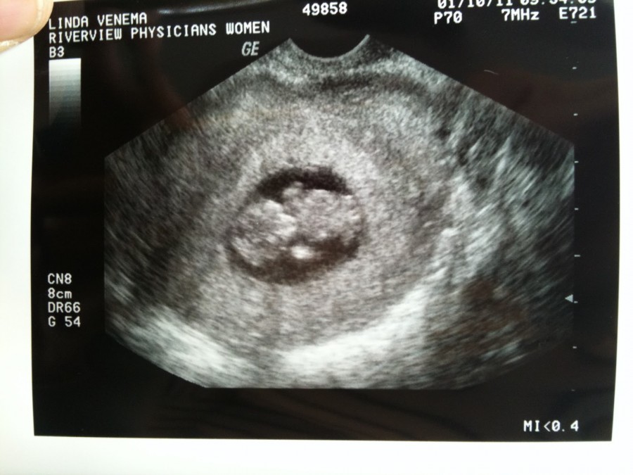 8 9 недель беременности фото плода фото