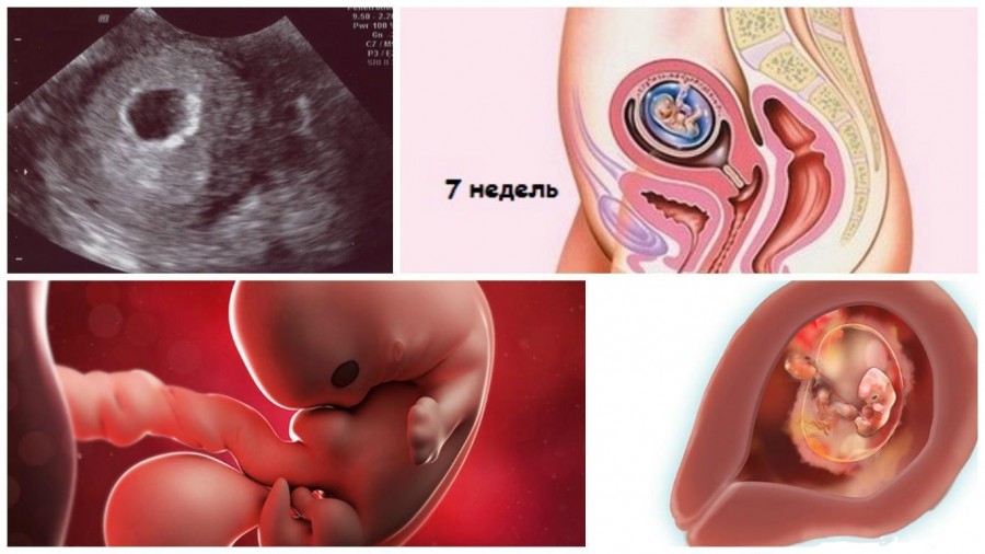 Беременность по неделям: ощущение матери, развитие плода и этапы формирование человека
