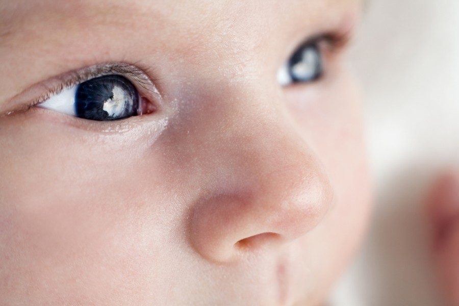 Baby closer. Конъюнктивит у новорожденных. Темно синие глаза у младенца. Конъюнктивит у грудничка. Конъюнктивит у новорожденного фото.