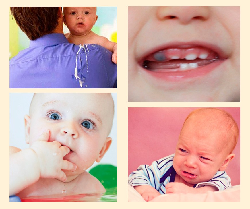 Что делать когда режутся зубки у ребенка в 1 год