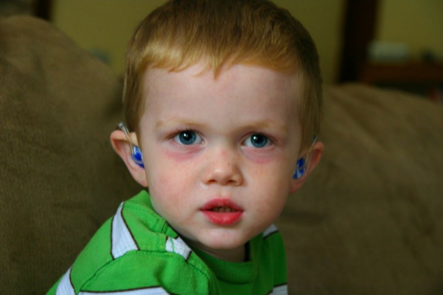 Лечение синяка под глазом у ребенка