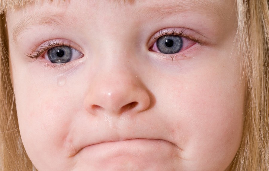 Гематома под глазом у ребенка лечение