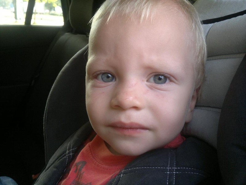 Ушиб глаза у ребенка синяки под глазами