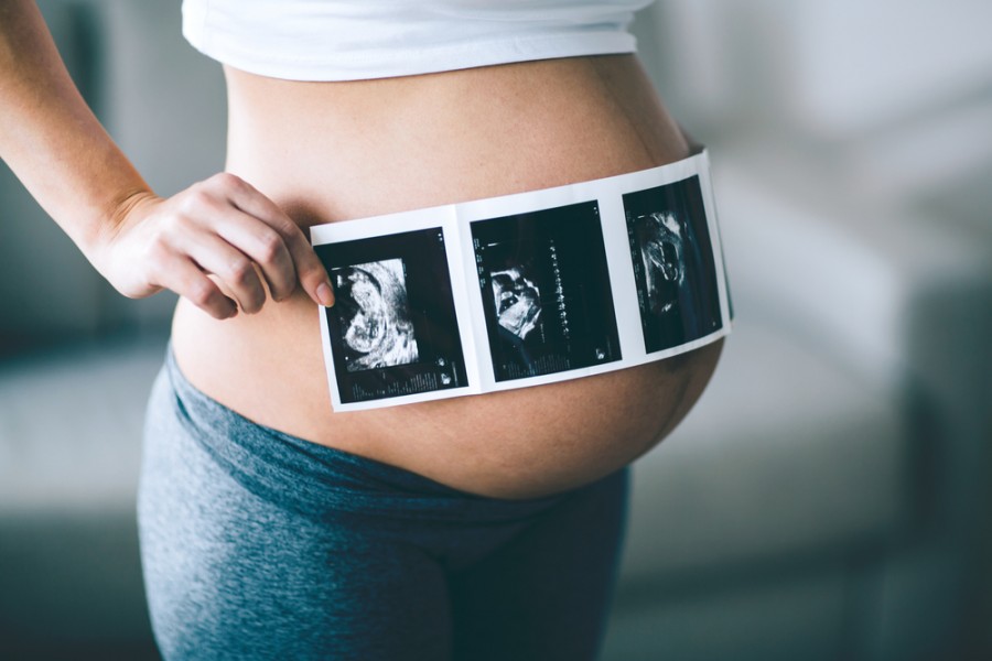 УЗИ при беременности - что показывает на разных сроках и вредность процедуры
